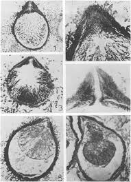 Attēlu rezultāti vaicājumam “Diderma simplex sessile”