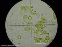Attēlu rezultāti vaicājumam “Perichaena corticalis”