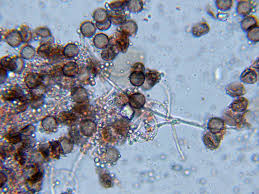 Attēlu rezultāti vaicājumam “Diderma hemisphaericum spores”