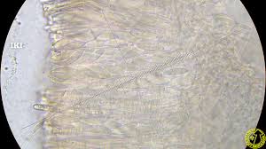 Attēlu rezultāti vaicājumam “Cudoniella acicularis”