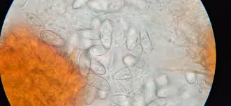 Attēlu rezultāti vaicājumam “Neonectria coccinea”