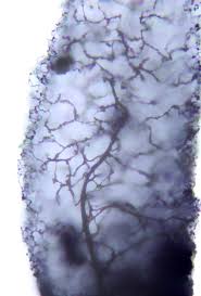 Attēlu rezultāti vaicājumam “Stemonitopsis hyperopta var. landewaldii stalked”