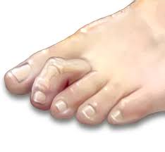 Znalezione obrazy dla zapytania palec