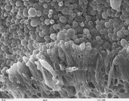 Attēlu rezultāti vaicājumam “Didymium bahiense spores”
