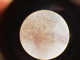 Attēlu rezultāti vaicājumam “Diachea leucopodia young”