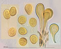 Attēlu rezultāti vaicājumam “Melampsora epitea”