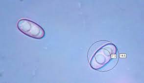 Attēlu rezultāti vaicājumam “Otidea bufonia”