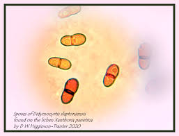 Attēlu rezultāti vaicājumam “Urocystis anemones spores”