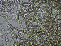 Attēlu rezultāti vaicājumam “Arcyria cinerea stalked”