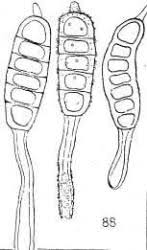 Attēlu rezultāti vaicājumam “Phragmidium sp.”