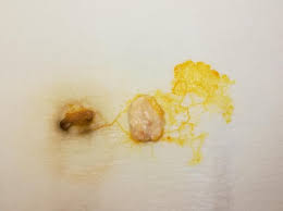 Attēlu rezultāti vaicājumam “Badhamia capsulifera”