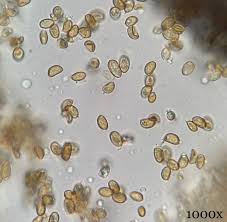 Attēlu rezultāti vaicājumam “Barbeyella minutissima spores”