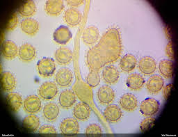 Attēlu rezultāti vaicājumam “Oligonema sp.”