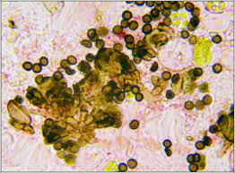 Attēlu rezultāti vaicājumam “Xanthoriicola physciae”