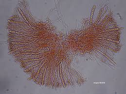 Attēlu rezultāti vaicājumam “Baeomyces rufus”