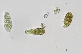 Attēlu rezultāti vaicājumam “Zygodon rupestris”