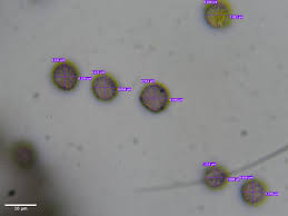 Attēlu rezultāti vaicājumam “Lamproderma puncticulatum spores”