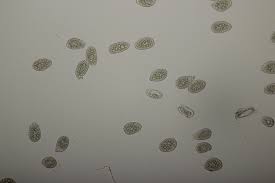 Attēlu rezultāti vaicājumam “Milesina murariae”