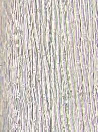 Attēlu rezultāti vaicājumam “Callicladium haldanianum”