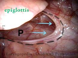 Attēlu rezultāti vaicājumam “Cribraria piriformis young”