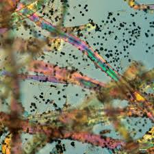 Attēlu rezultāti vaicājumam “Cribraria atrofusca spores”