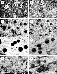 Attēlu rezultāti vaicājumam “Mycoblastus sanguinarius”