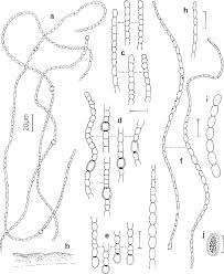 Attēlu rezultāti vaicājumam “Nostoc pruniforme macro”