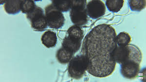 Attēlu rezultāti vaicājumam “Dianema depressum spores”