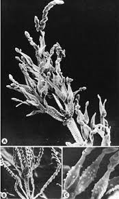 Attēlu rezultāti vaicājumam “Arcyria globosa young”