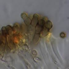 Attēlu rezultāti vaicājumam “Xanthoriicola physciae”