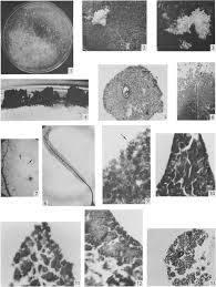 Attēlu rezultāti vaicājumam “Stemonitis herbatica spores”