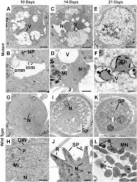 Attēlu rezultāti vaicājumam “Diachea muscorum plasmodium”
