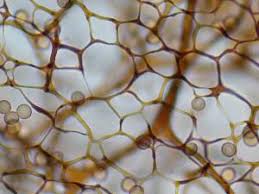 Attēlu rezultāti vaicājumam “Stemonitis flavogenita macro”