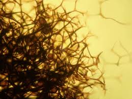 Attēlu rezultāti vaicājumam “Lamproderma gulielmae”