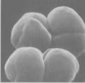 Morphology of the Archaea