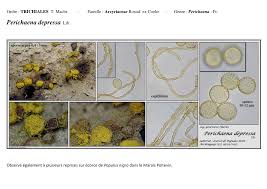 Attēlu rezultāti vaicājumam “Perichaena depressa spores”