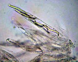 Attēlu rezultāti vaicājumam “Lasiosphaeria ovina spores”