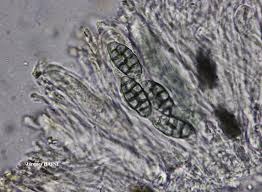 Attēlu rezultāti vaicājumam “Diachea muscorum spores”