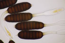 Attēlu rezultāti vaicājumam “Phragmidium sp.”