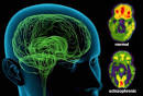 Schizophrenia Slideshow: How Schizophrenia Affects Thoughts ...