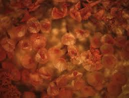 Attēlu rezultāti vaicājumam “Arcyria affinis spores”