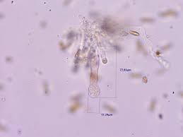 Attēlu rezultāti vaicājumam “Microbotryum tragopogonis - pratensis”