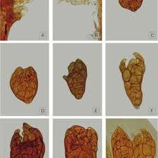 Attēlu rezultāti vaicājumam “Pohlia wahlenbergii sporophyte”