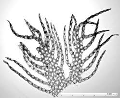 Attēlu rezultāti vaicājumam “Ptilidium pulcherrimum sporophyte”