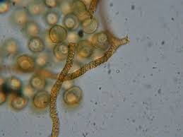 Attēlu rezultāti vaicājumam “Trichia contorta”