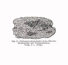 Attēlu rezultāti vaicājumam “Pertusaria coccodes”