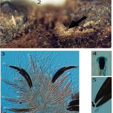 Attēlu rezultāti vaicājumam “Rosellinia desmazieri spores”