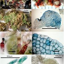 Attēlu rezultāti vaicājumam “Fossombronia foveolata sporophyte”