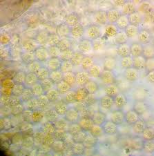 Attēlu rezultāti vaicājumam “Lycogala sphaeroconicum”