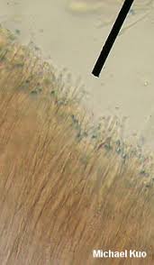 Attēlu rezultāti vaicājumam “Ascocoryne cylichnium”